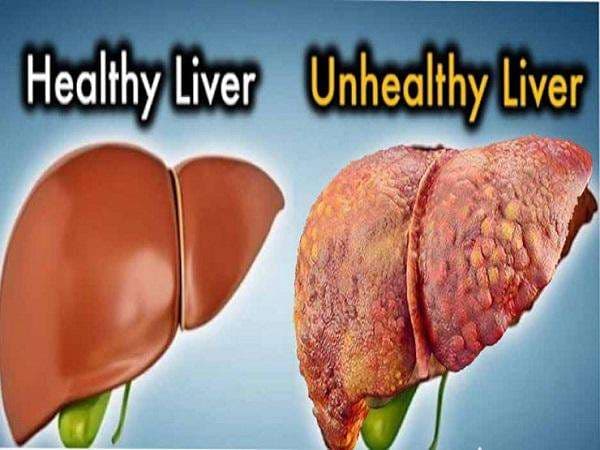 Liver Detox Supplements: Natural Support for Liver Repair & Function in Accra, Ghana