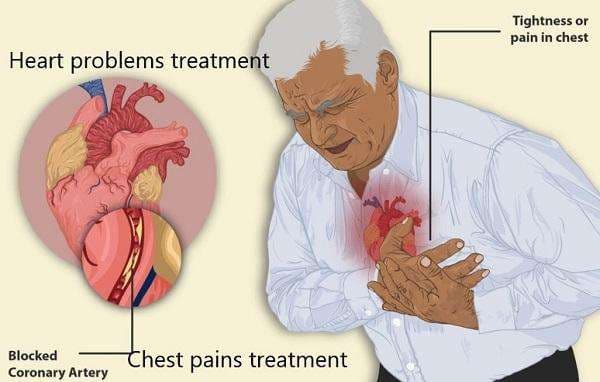 Cardiac Arrest Treatment: Effective Medicine & Emergency Care in Accra, Ghana