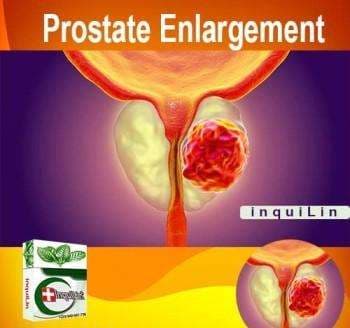 Prostate Enlargement Treatment: Effective Medicine & Supplements in Accra, Ghana
