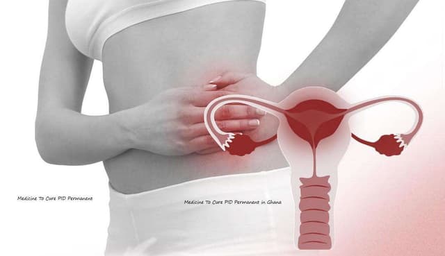 Pelvic Inflammatory Disease (PID) Treatment: Effective Medicine & Remedies in Accra, Ghana